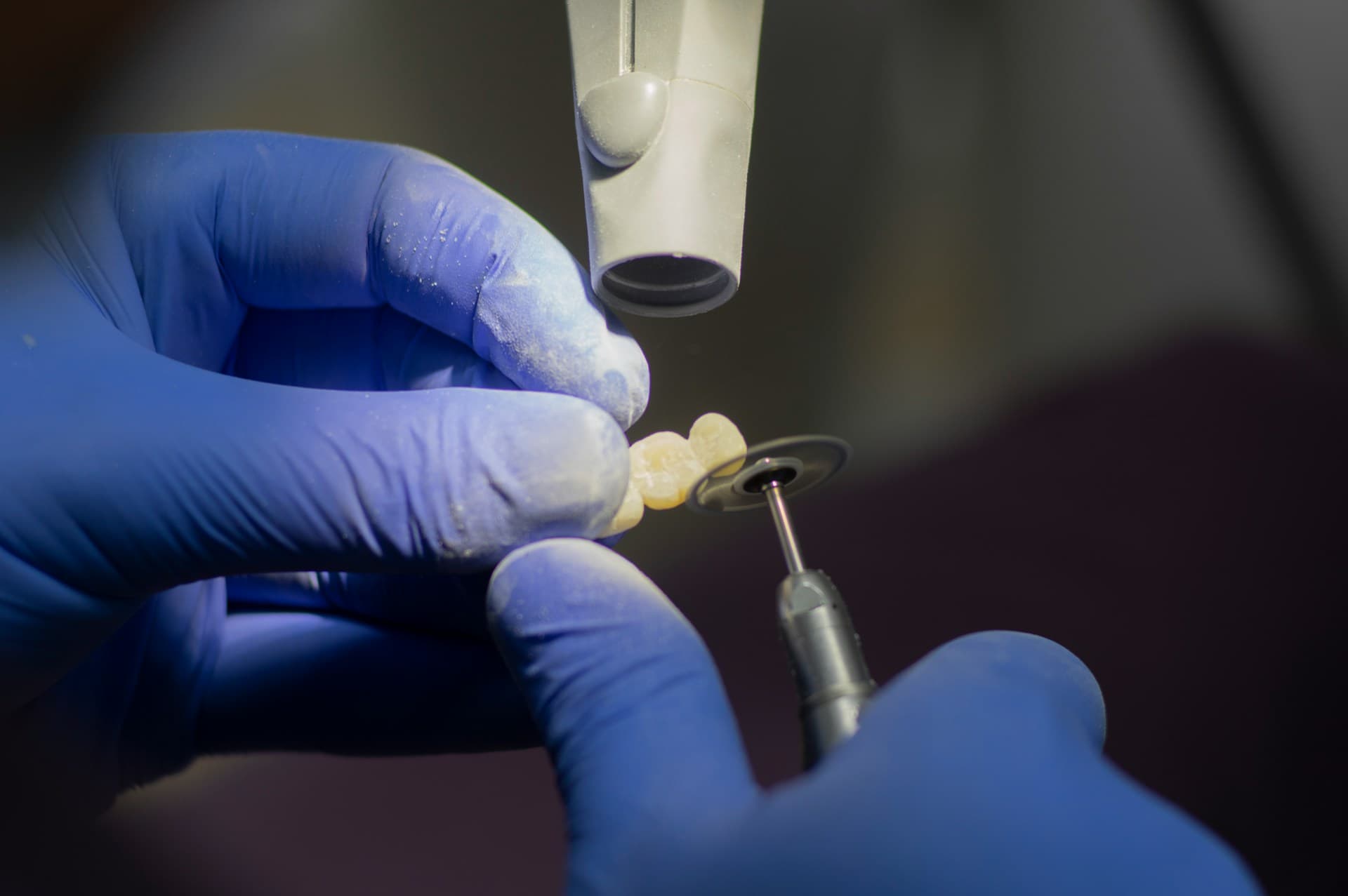 Close-up illustration of a porcelain dental bridge replacing a missing tooth.