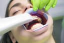 How Intraoral Scanners Are Changing Dental Impressions