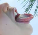 Dry Mouth (Xerostomia): Risks for Teeth and Gums—and Practical Relief