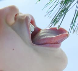 Dry Mouth (Xerostomia): Risks for Teeth and Gums—and Practical Relief