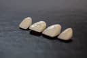 Porcelain Veneers: Who They Suit and How Long They Last
