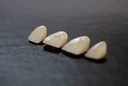 Porcelain Veneers: Who They Suit and How Long They Last