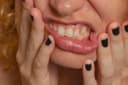 Gum Recession: Why Gums Pull Back and How to Protect Your Roots
