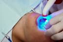 The Truth About Teeth Whitening: Myths vs. Facts